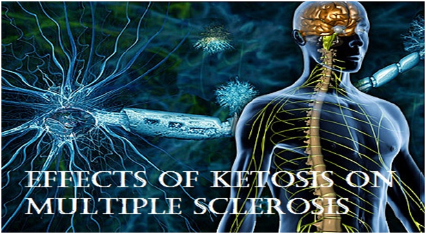 ketogenic-diet for Multiple Sclerosis