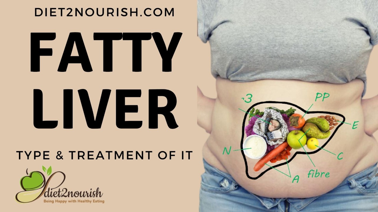 Fatty Liver Diet Chart