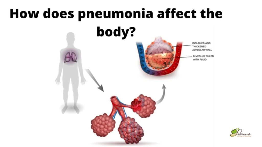 Pneumonia affects the body