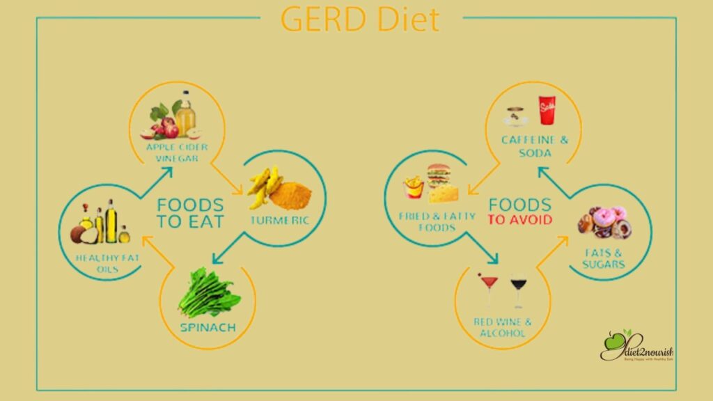 GERD foods to avoid Advise by Nutritionist or Dietician