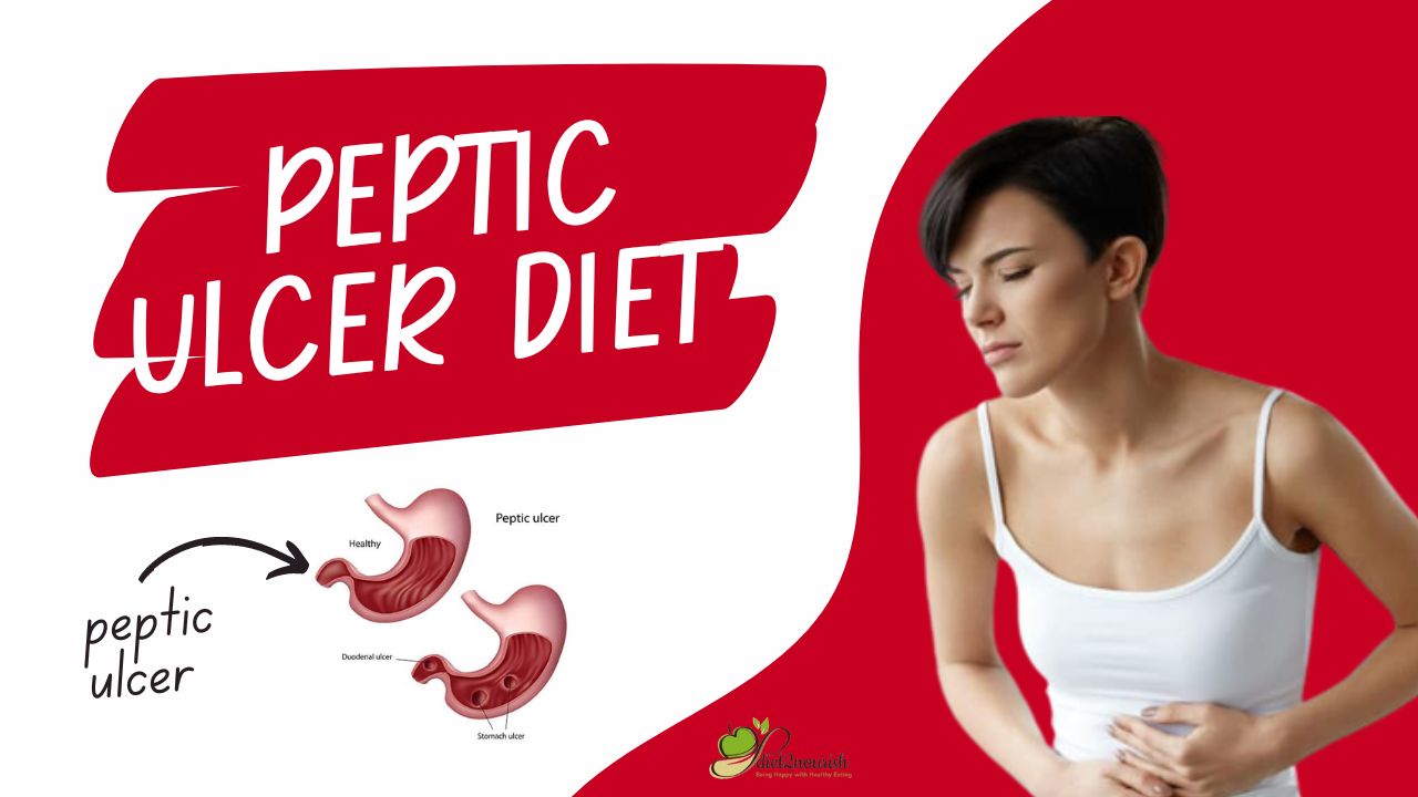 Peptic Ulcer Diet
