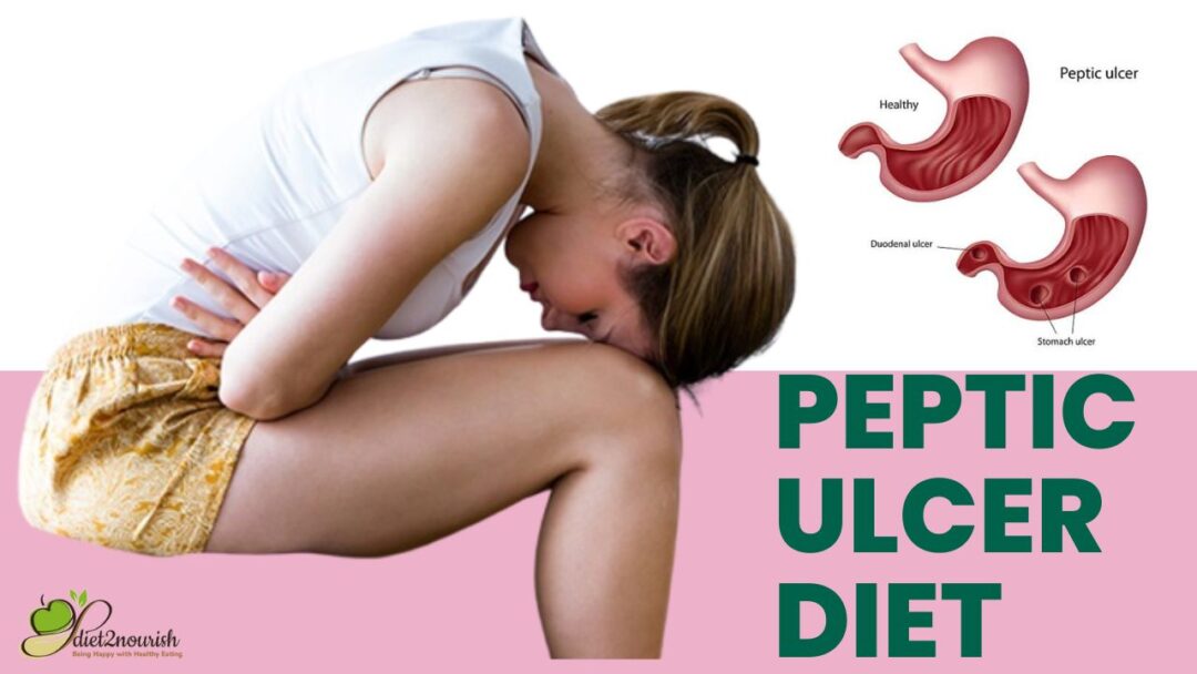 Peptic Ulcer Diet