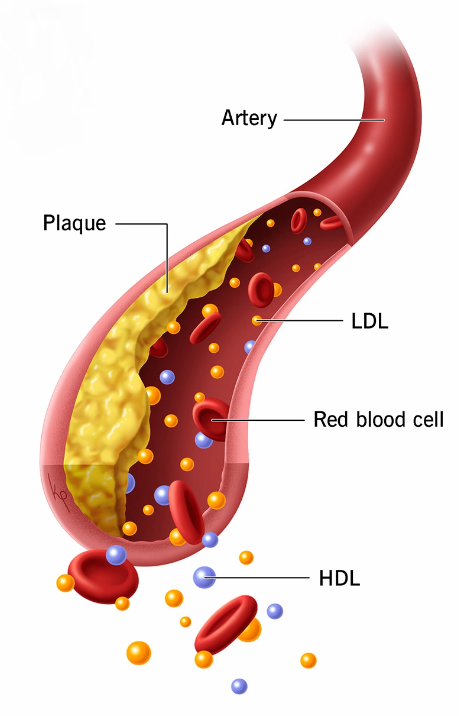 What is cholesterol