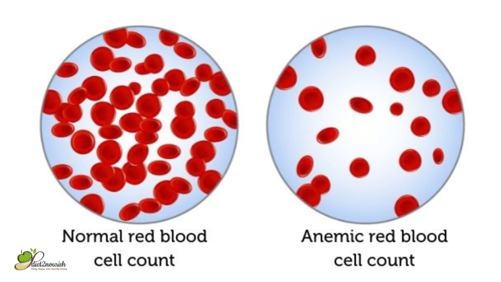 What is anemia