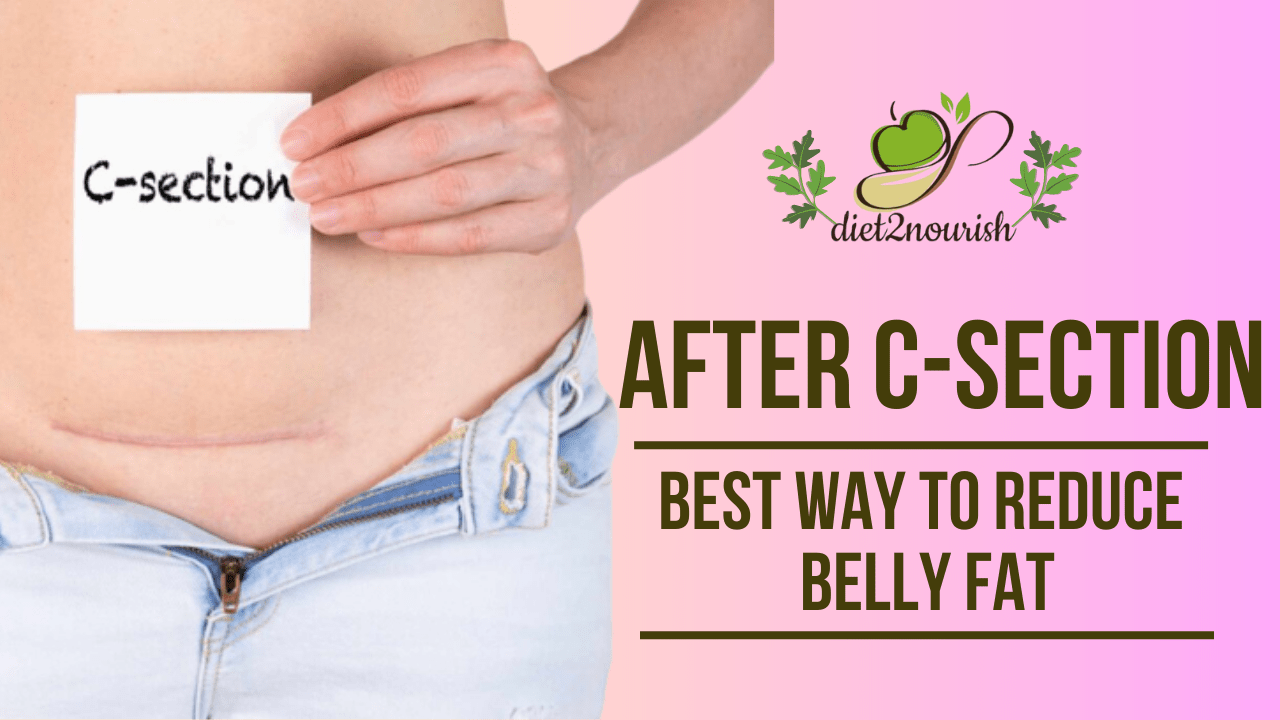 How to Reduce Belly Fat After C-section Delivery