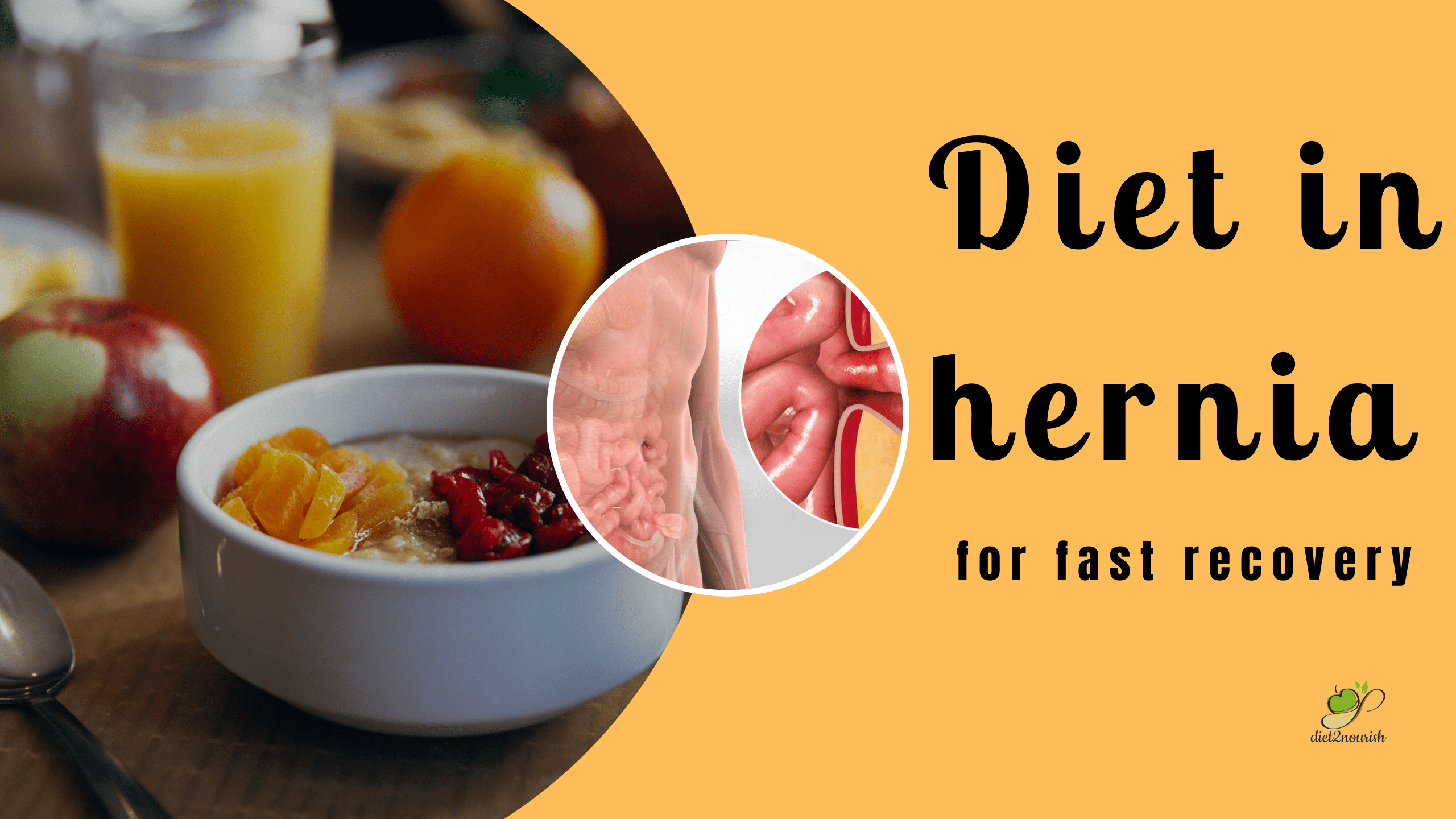 diet in hernia