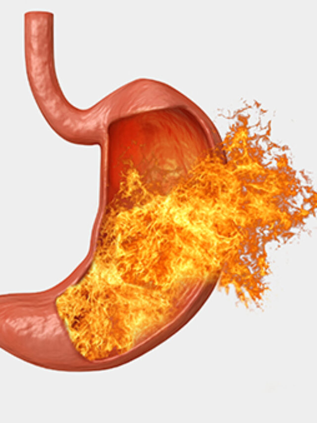 Image-of-stomach-burning-sensation