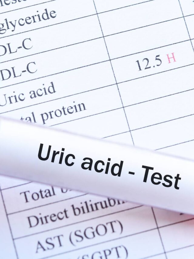 uric-acid-1