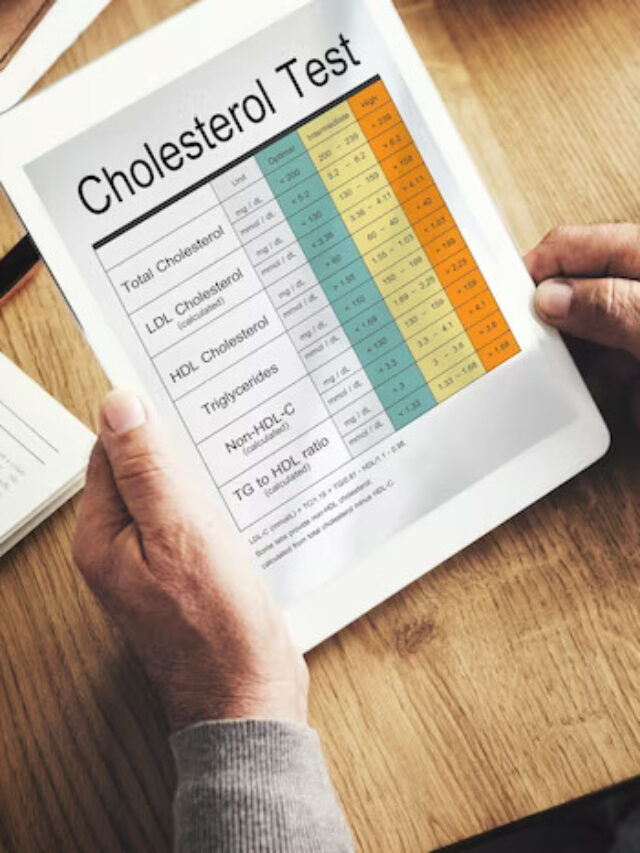 Cholesterol-Levels