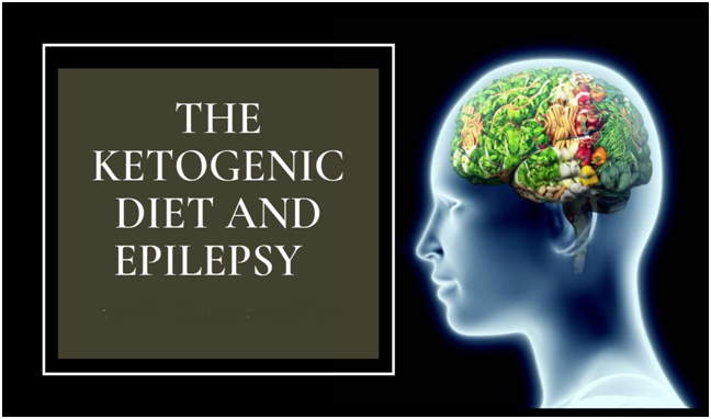 Ketogenic Diet for Epilepsy