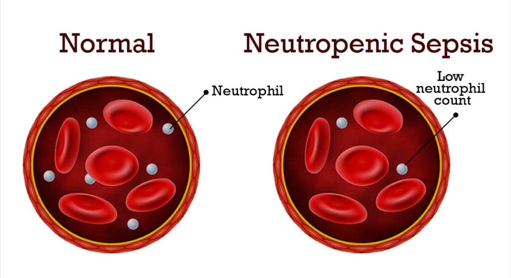 What is a neutropenic diet?