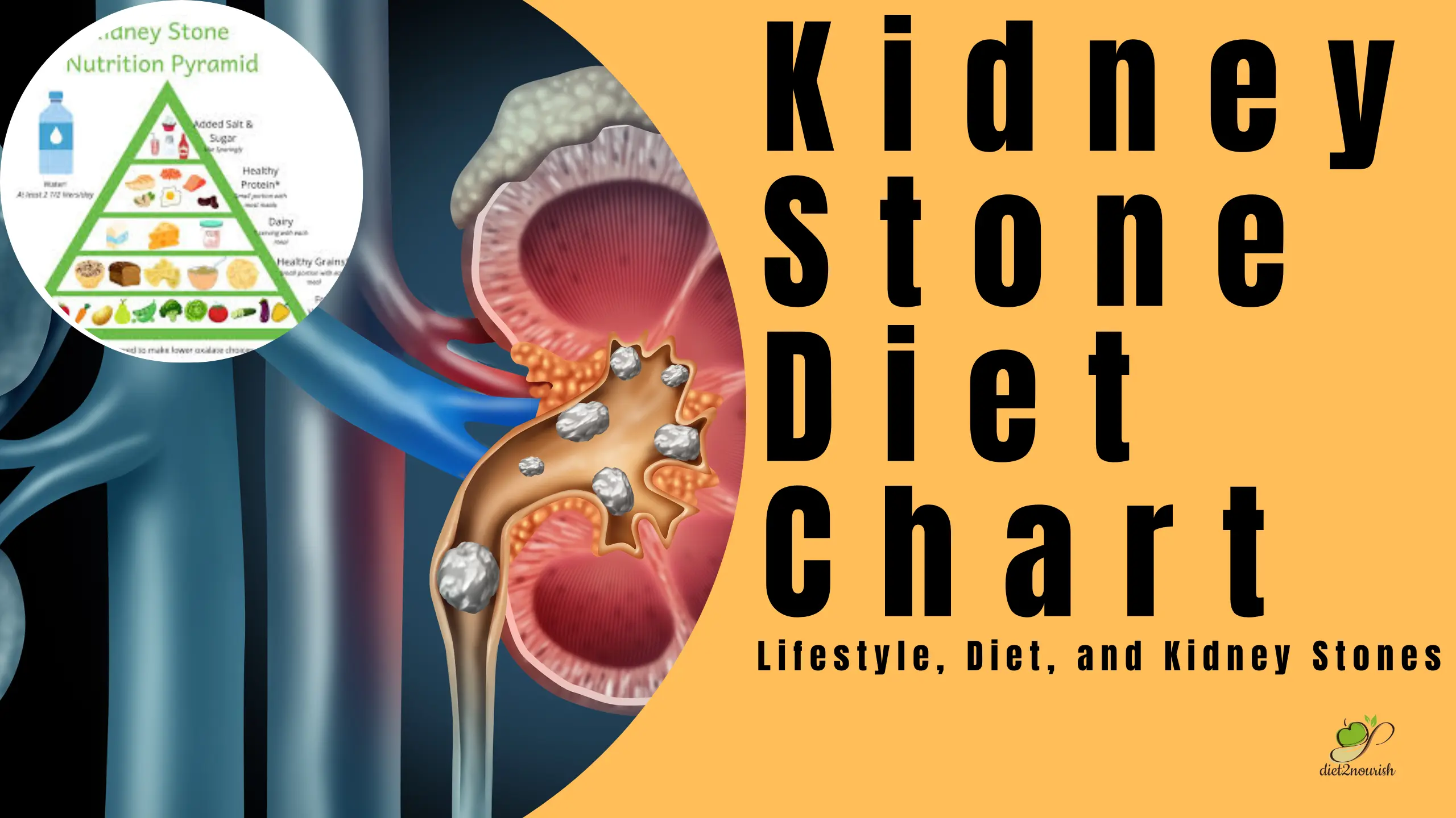 Kidney Stone Diet Chart