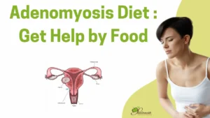 What is the Best treatment Diet for Adenomyosis ?