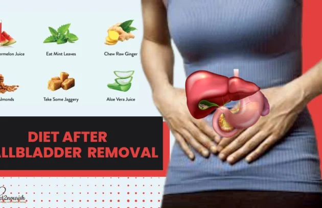 Diet After Gallbladder Removal