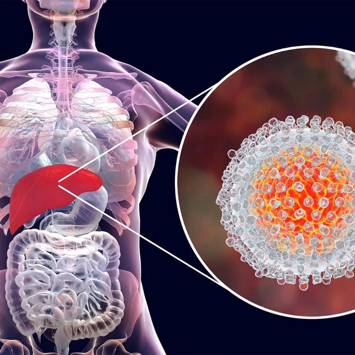 Those with Hepatitis (Viral/Autoimmune)
