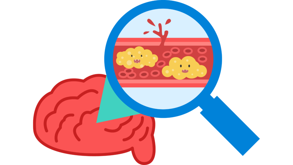 How do triglycerides affect your heart